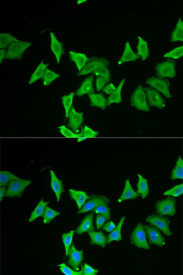 MLN / Motilin Antibody