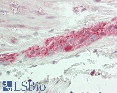 IHC-plus™ OXSR1 / OSR1 Antibody (Internal)