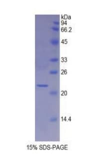 Human MYL4 Protein (Recombinant His)