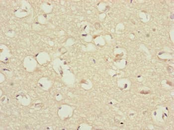 Polyclonal Rabbit anti-Human CEP83 / CCDC41 Antibody (IHC, IF, WB)