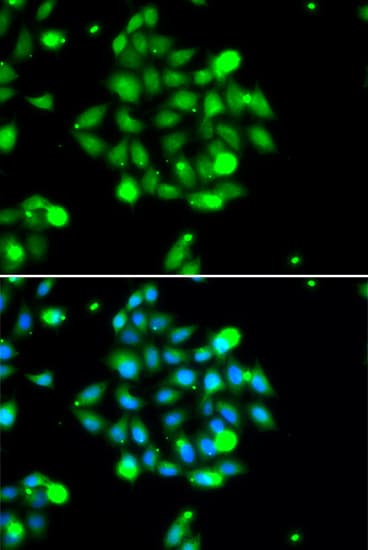 Polyclonal Rabbit anti-Human UBE2G1 Antibody (IHC, IF, WB)