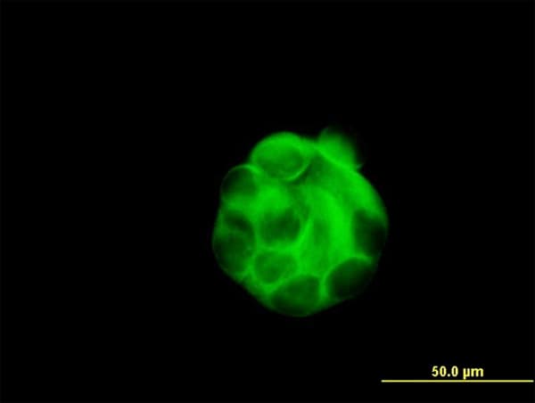 IHC-plus™ Monoclonal Mouse anti-Human SGCB / SGC / Sarcoglycan Beta Antibody (clone 1C10, IHC, IF, WB)
