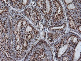 NDUFB10 Antibody (clone OTI4F1)