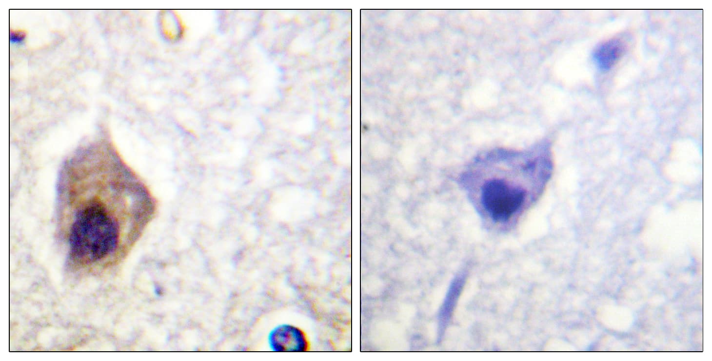 CASP1 / Caspase 1 Antibody (aa342-391)