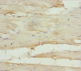 Polyclonal Rabbit anti-Human GNA15 Antibody (IHC, WB)