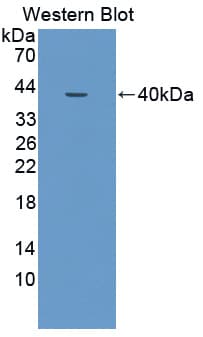 NCOA3 / SRC-3 / AIB1 Antibody (aa1023-1304)