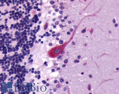 PathPlus™ CXCR4 Antibody (Cytoplasmic Domain)