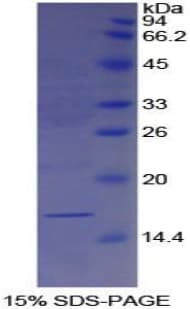 Human LGALS7 / Galectin 7 Protein (Recombinant His)