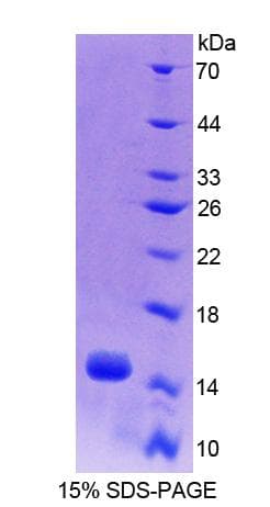 Mouse ACYP2 Protein (Recombinant His-T7)