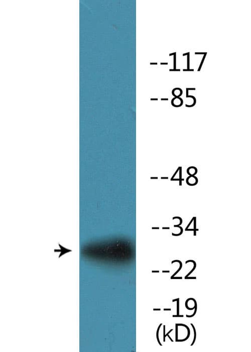 RPS6 / Ribosomal Protein S6 Antibody (phospho-Ser235)