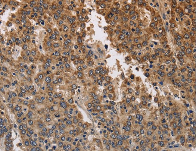 KCNK9 / TASK3 Antibody