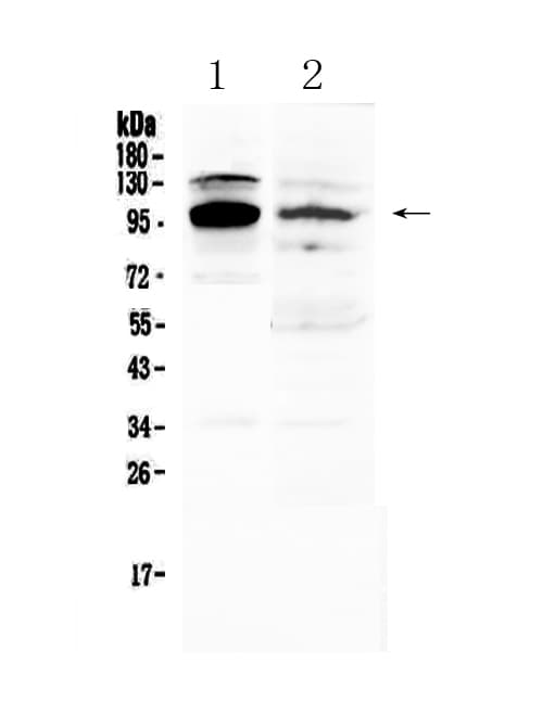 Polyclonal Rabbit anti-Human NFATC1 / NFAT2 Antibody (IHC, WB)