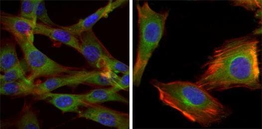GSK3B / GSK3 Beta Antibody (clone 3D10)
