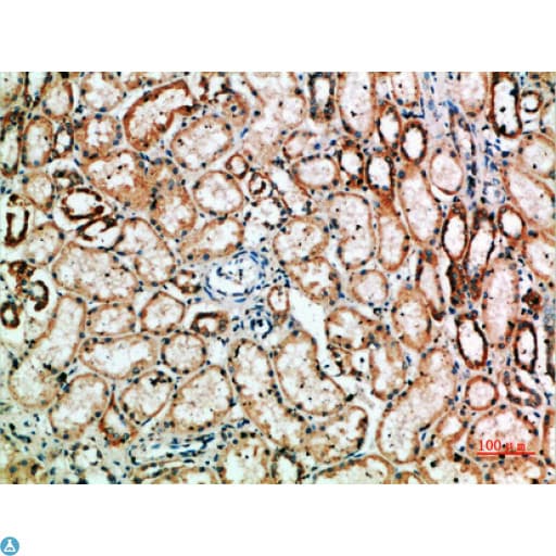 Polyclonal Rabbit anti-Human YARS / Tyrosyl-tRNA Synthetase Antibody (WB)