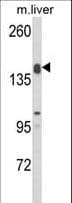 ADAMTS18 Antibody (aa1066-1095)