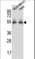 PRCP Antibody (aa114-143)