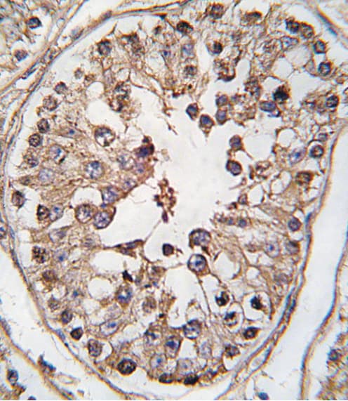 NAK / TBK1 Antibody (Ser172)
