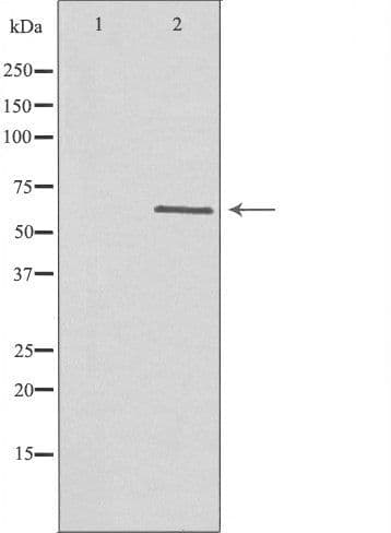 HEXB Antibody