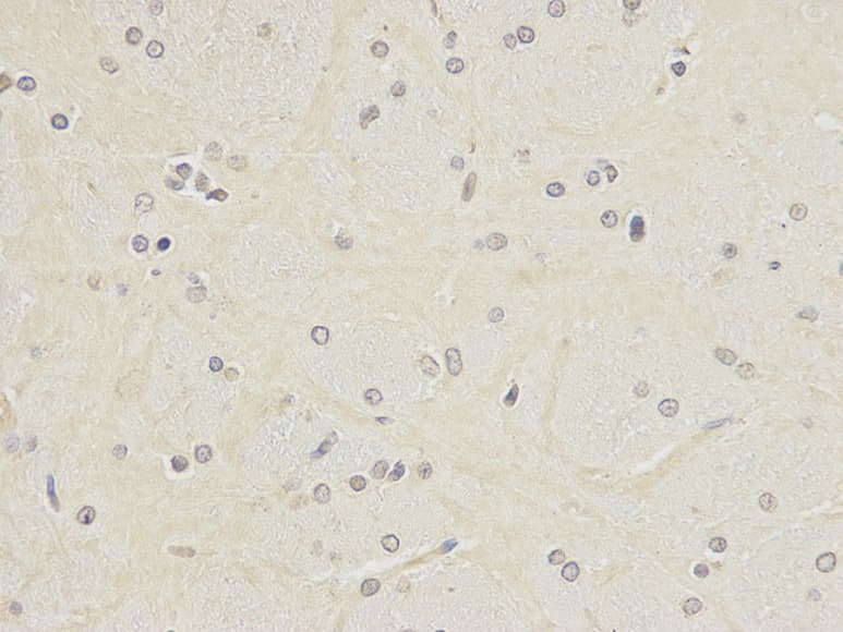 POLH / DNA Polymerase Eta Antibody