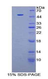 Human FGF6 Protein (Recombinant His-GST)