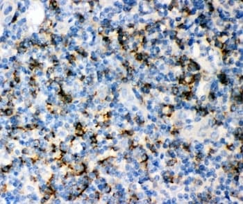 Polyclonal Rabbit anti-Human CD8 Antibody (aa22-187, IHC, WB)
