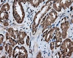 LIPG / Endothelial Lipase Antibody (clone OTI4A8)