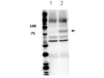 STAT3 Antibody (phospho-Tyr705)
