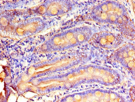 MTTP / MTP Antibody