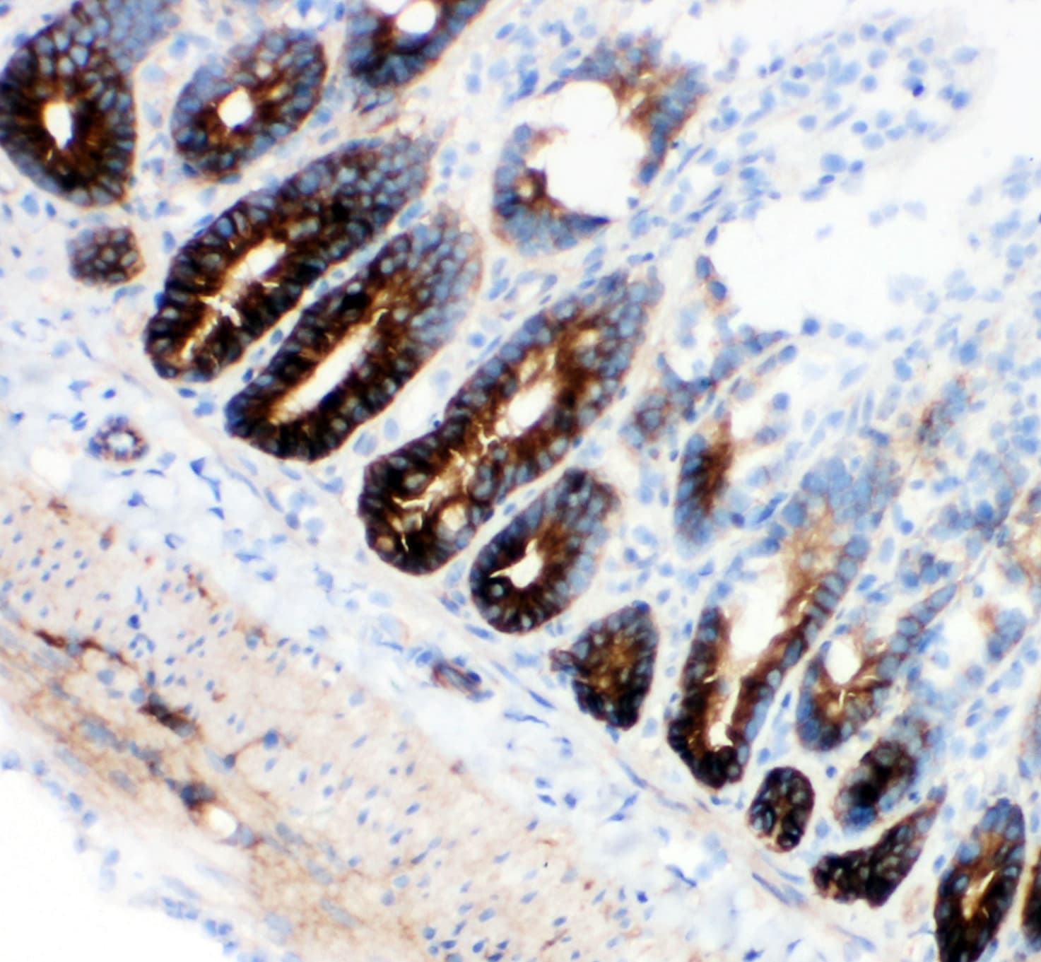 SLC12A2 / NKCC1 Antibody (aa223-241)