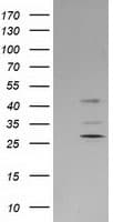 SERPINB2 / PAI-2 Antibody (clone OTI4A3, Carrier-free)