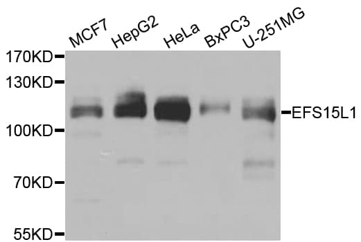 EPS15L1 / EPS15R Antibody