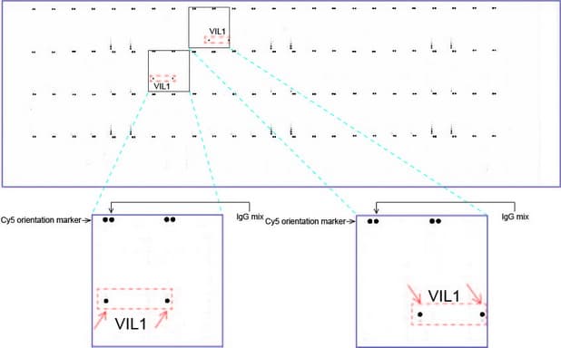 VIL1 / Villin Antibody (aa1-188, clone UMAB230)