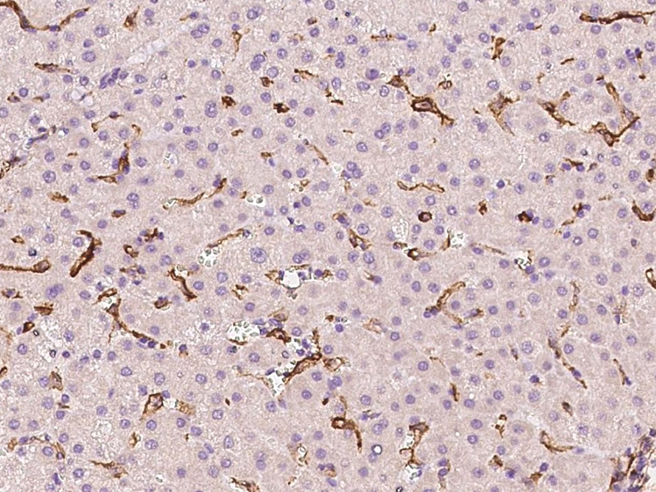 VCAM1 / CD106 Antibody (Preservative Free)