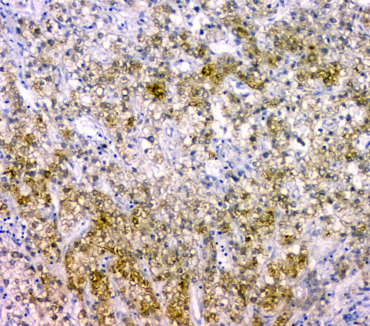 CDKN1B / p27 Kip1 Antibody (aa10-198)