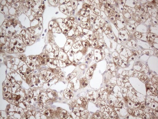 CAMK2B / CaMKII Beta Antibody (aa311-385, clone OTI8D9)