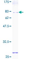 Human PDIA6 / ERP5 Protein (Recombinant GST)