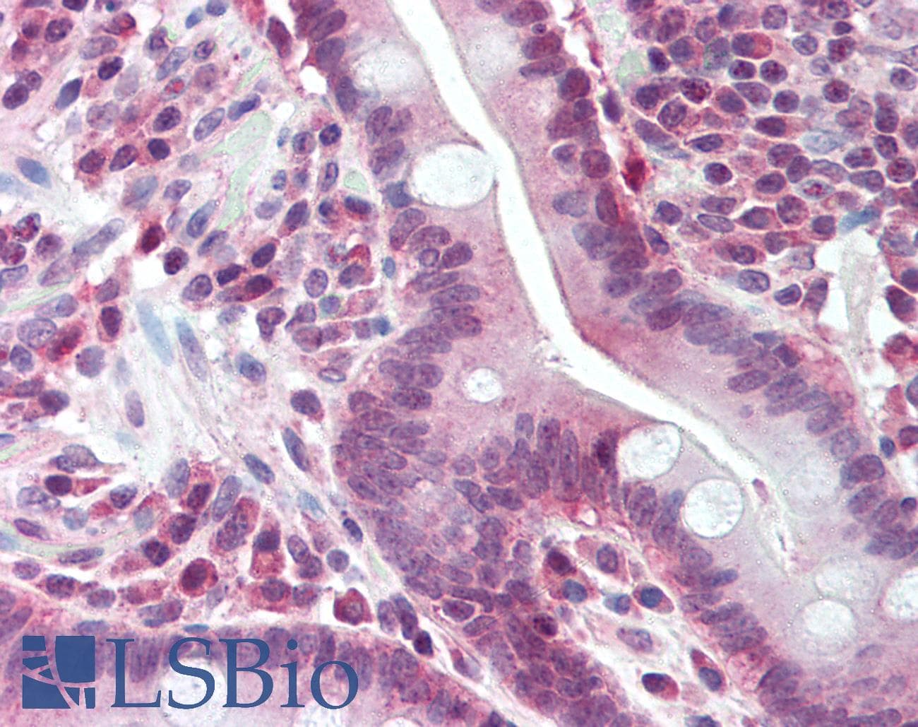 IHC-plus™ Polyclonal Rabbit anti-Human BUB1 Antibody (IHC, IF, WB)