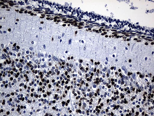 PHF20L1 Antibody (clone OTI6G6, Carrier-free)