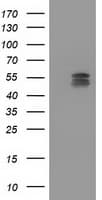 CYP2C9 / Cytochrome P450 2C9 Antibody (clone OTI3D2)