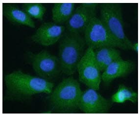 ALDOA / Aldolase A Antibody (clone AT3F9)
