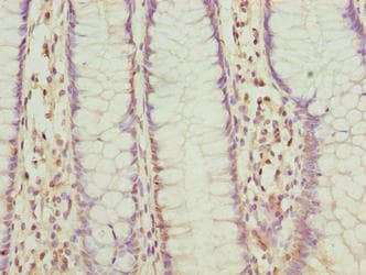 FLAD1 / FADS Antibody (aa1-490)