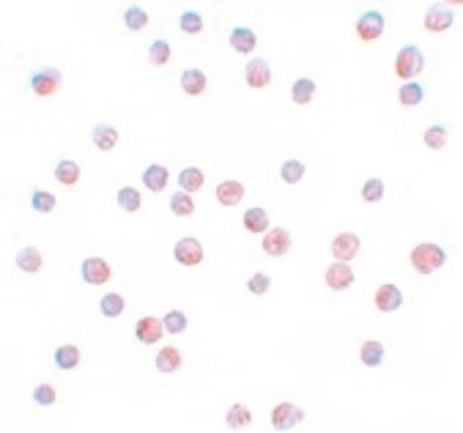 IHC-plus™ Polyclonal Rabbit anti-Human FOXO4 / AFX1 Antibody (IHC, IF, WB)