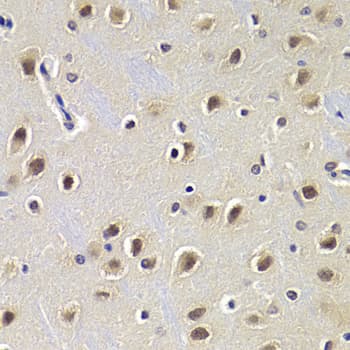 Polyclonal Rabbit anti-Human CDKN1B / p27 Kip1 Antibody (IHC, IF, WB)