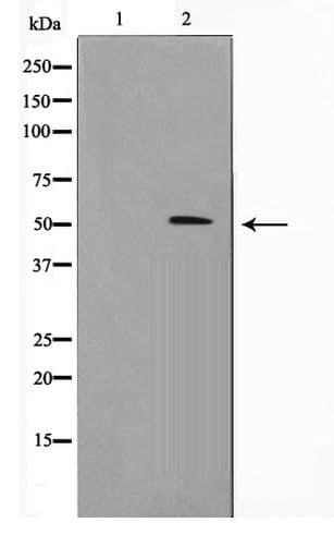 RNF14 / ARA54 Antibody