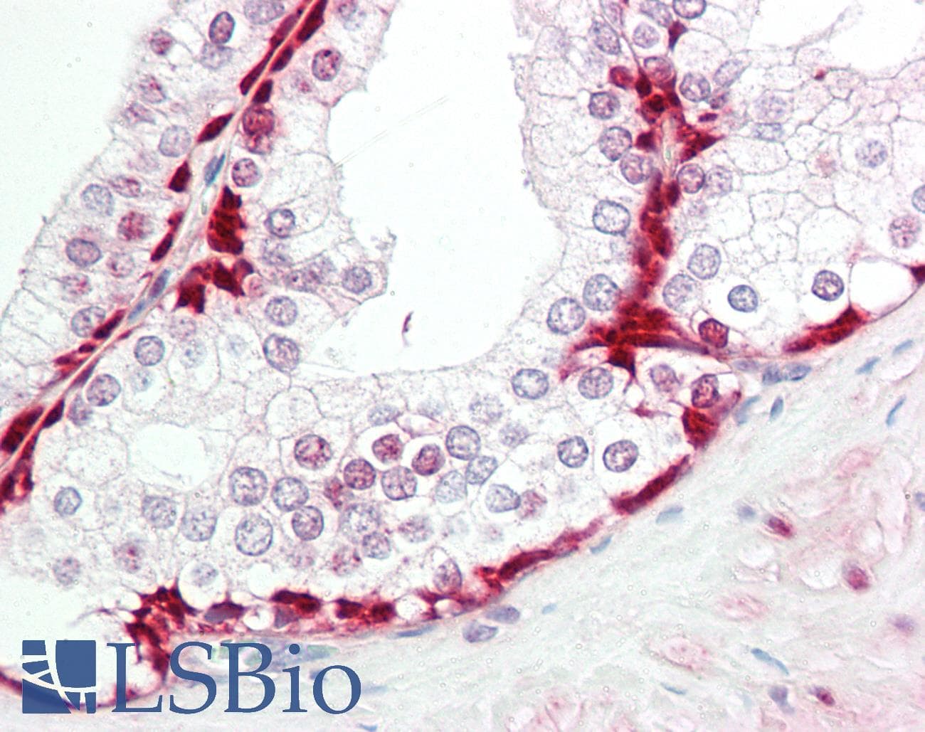 Heat Shock Protein 70 / HSPA1A Antibody (aa492-541)