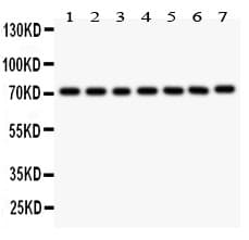 FOXO3 / FOXO3A Antibody (aa471-673)