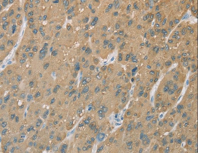Polyclonal Rabbit anti-Human CYP2C9 / Cytochrome P450 2C9 Antibody (IHC)