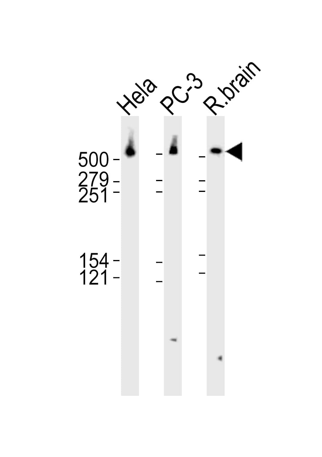 DYNC1H1 Antibody (aa4224-4257)