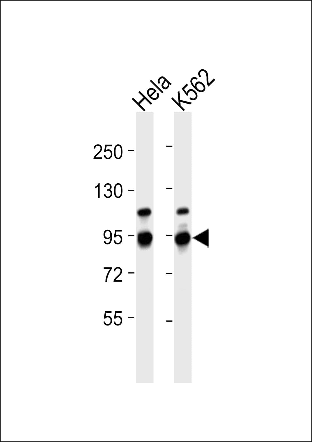 NF90 / ILF3 Antibody