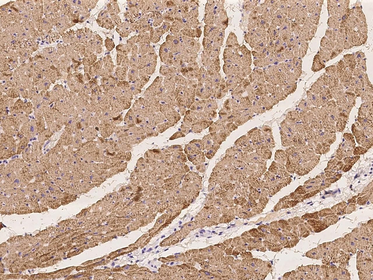 Polyclonal Rabbit anti-Human MYL2 Antibody (IHC)